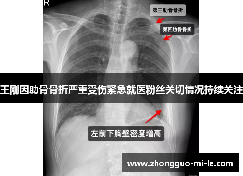 王刚因肋骨骨折严重受伤紧急就医粉丝关切情况持续关注
